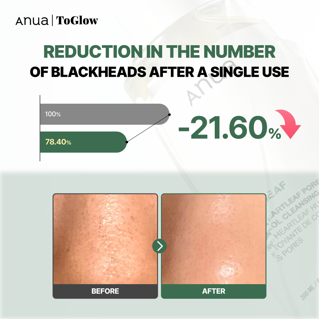 [Anua] Heartleaf Pore Control Cleansing Oil 200ml | Removes Blackheads & Controls Excess Sebum
