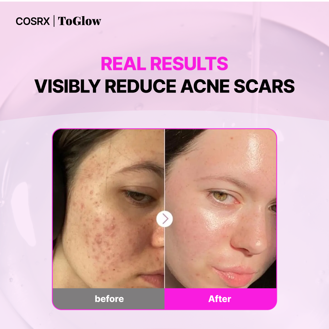 [COSRX] The Niacinamide 15 Serum 20ml | Intensive Brightening & Blemish Care