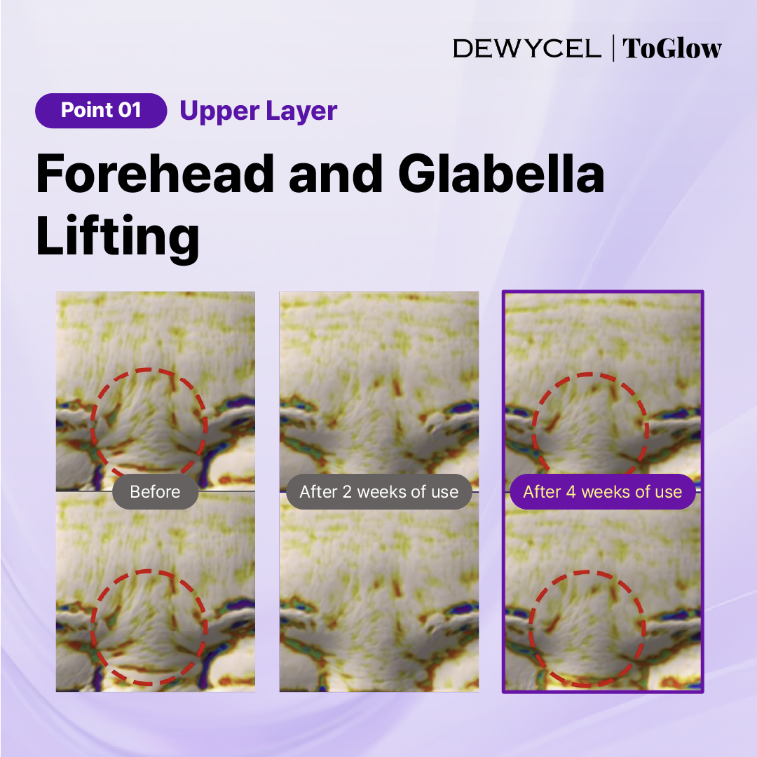 DEWYCEL 7 Lifting Mask (4pcs) 16g | Elasticity-Boosting Mask for Lifted & Tight Skin