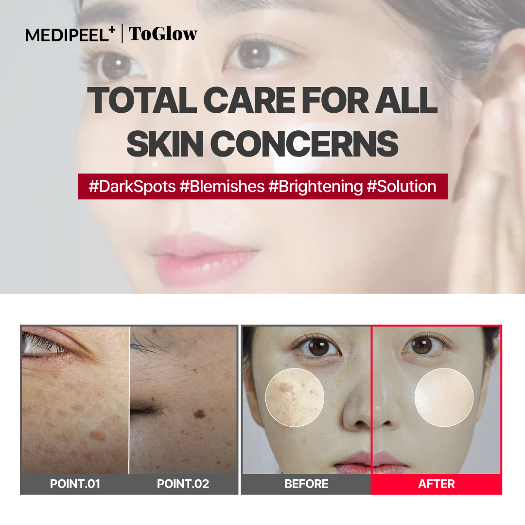 [MEDIPEEL] Melanon X Cream 30ml | Brightening Cream for Dark Spot Care