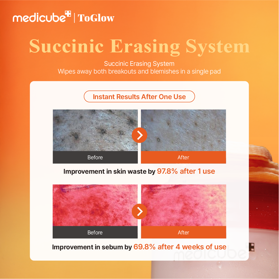 [medicube] Red Succinic Acid Peeling Pad 155g | Exfoliating Pads for Acne-Prone Skin