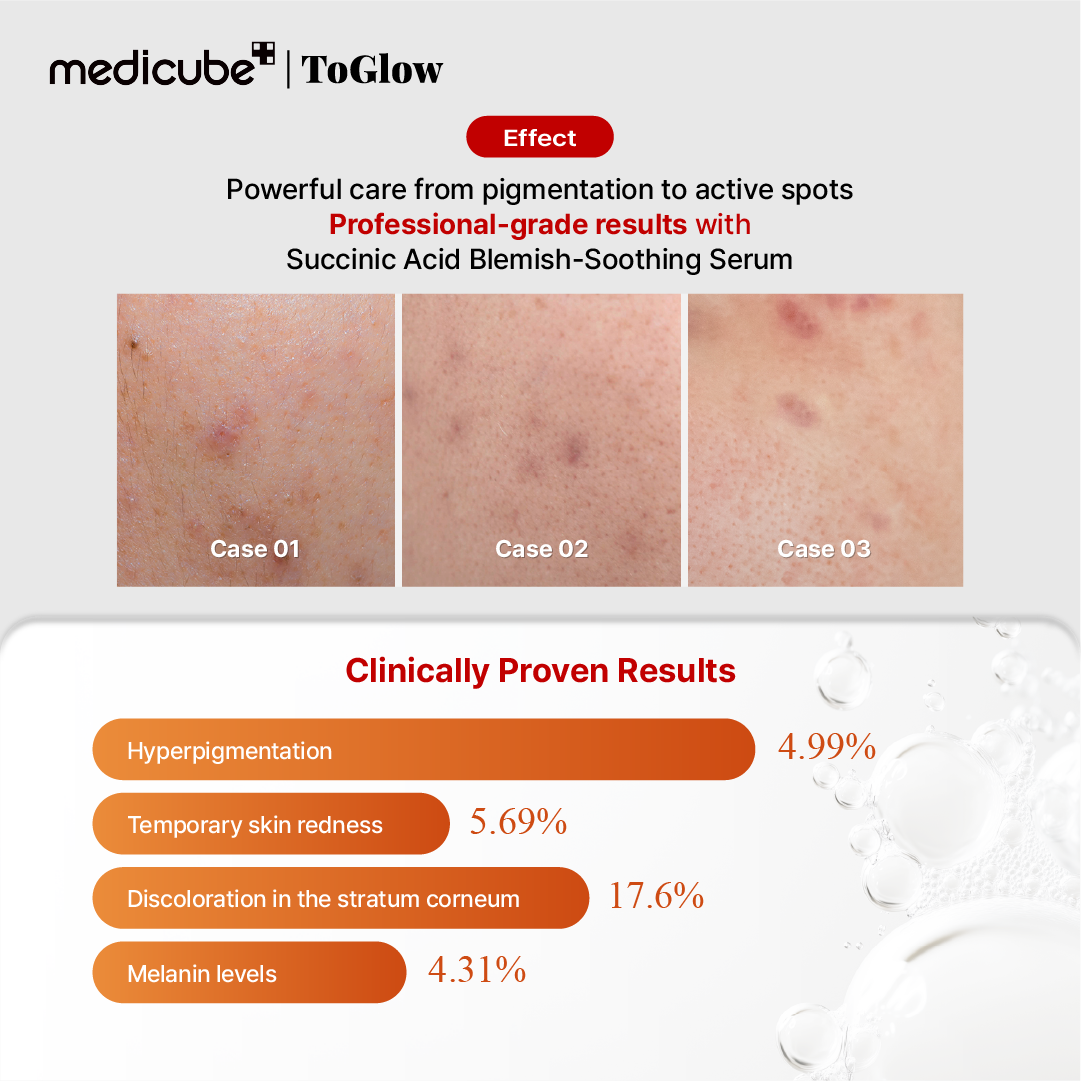 [medicube] Red Succinic Acid Serum 30ml | Acne-Clearing Serum with Succinic Acid