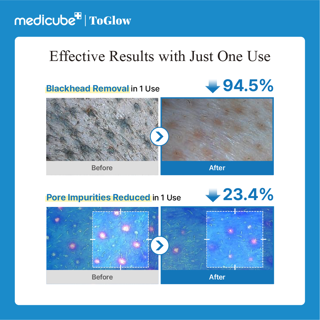 [medicube] Zero Pore Blackhead Deep Cleansing Oil 205ml | Blackhead-Dissolving Oil Cleanser for Smooth Skin