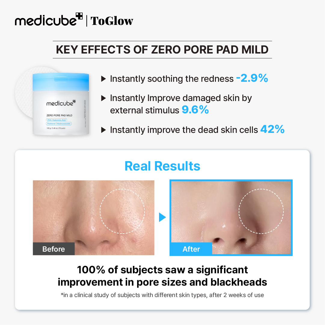 [medicube] Zero Pore Pad 2.0 Mild 155g | Gentle Exfoliating Pads for Sensitive Skin