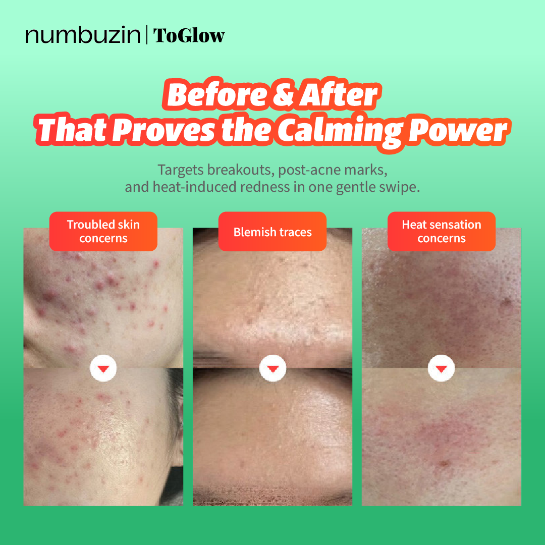 [numbuzin] No.1 Centella Re-leaf Green Toner Pad 70pcs | Centella Toner Pads for Skin Barrier Care