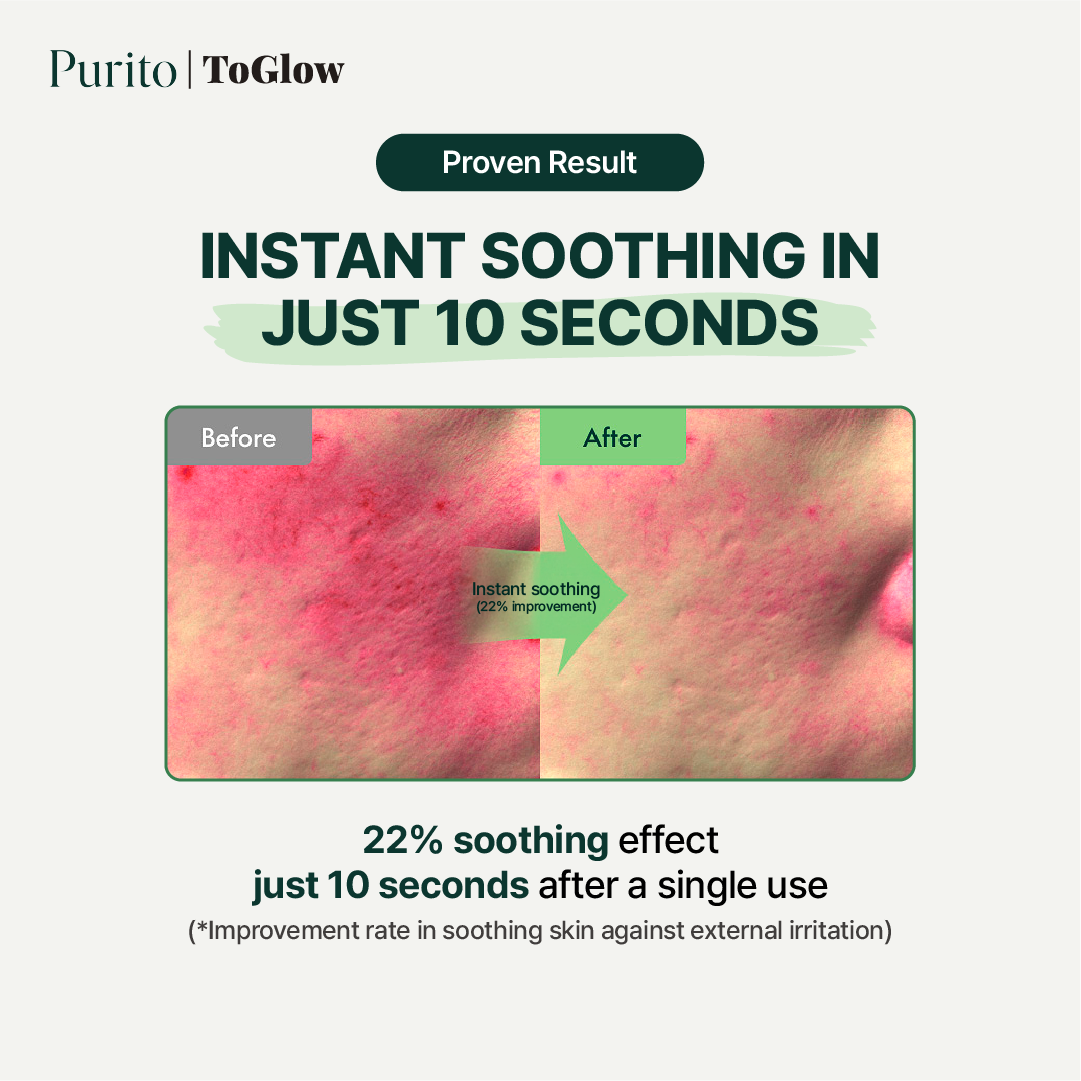 [Purito] Wonder Releaf Centella Serum Unscented 60ml | Calming Serum for Sensitive & Irritated Skin