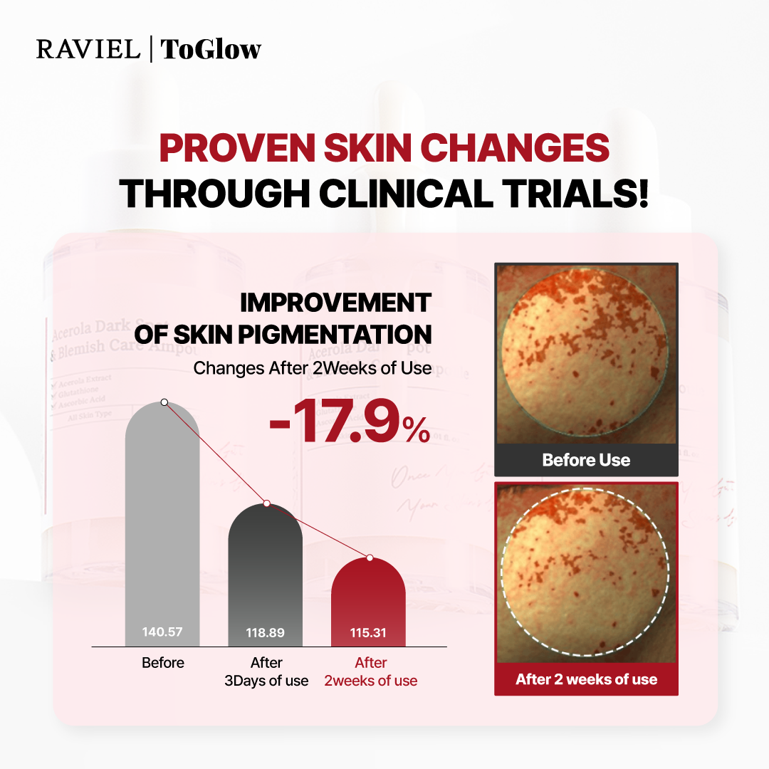 [RAVIEL] Acerola Dark Spot & Blemish Care Ampoule 30ml | Intensive Spot Treatment for Brighter, Smoother Skin