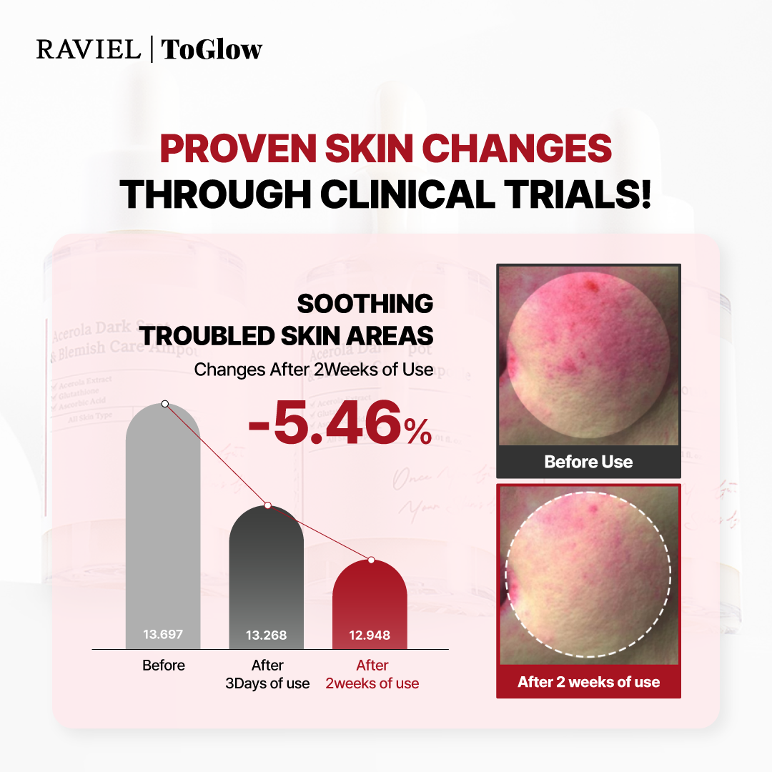 [RAVIEL] Acerola Dark Spot & Blemish Care Ampoule 30ml | Intensive Spot Treatment for Brighter, Smoother Skin
