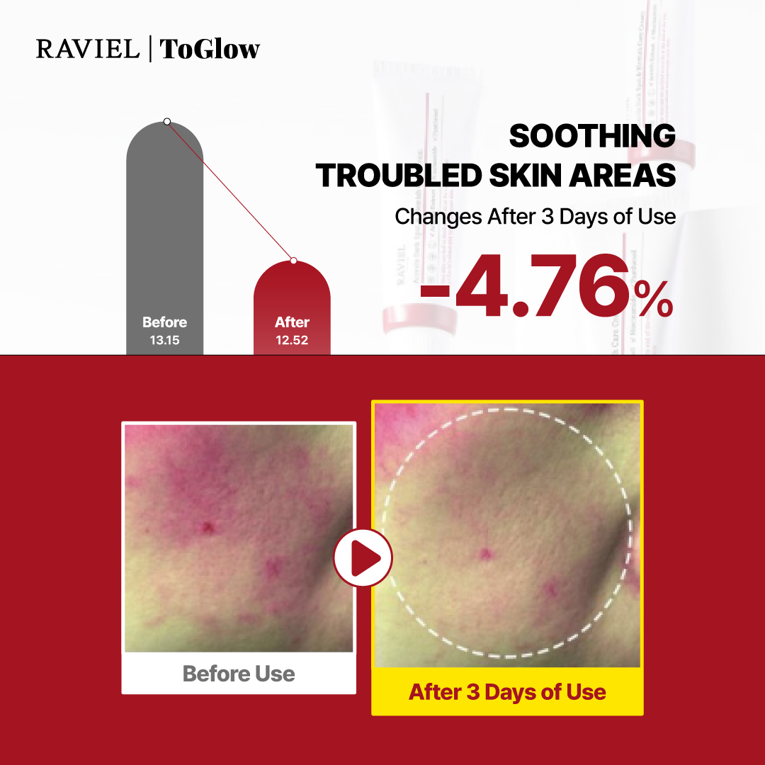 [RAVIEL] Acerola Dark Spot & Blemish Care Cream 50ml | Brightening Cream for Clear, Even-Toned Skin