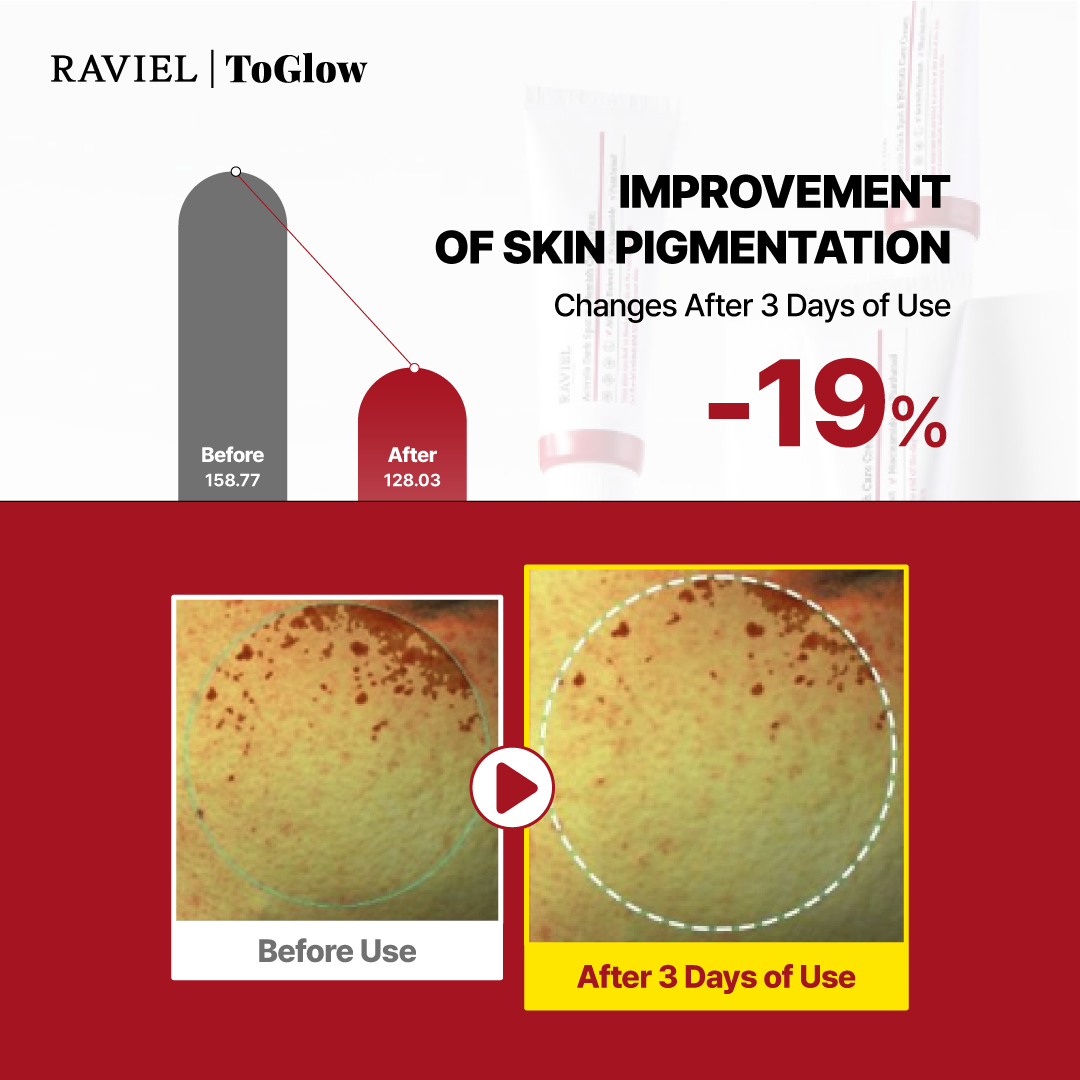 [RAVIEL] Acerola Dark Spot & Blemish Care Cream 50ml | Brightening Cream for Clear, Even-Toned Skin