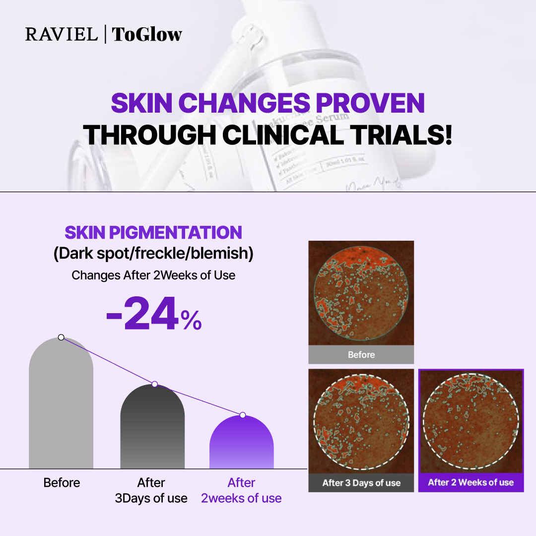 [RAVIEL] Bakuchiol Mela Free Serum 30ml | Plant-Based Brightening Serum for Youthful Glow