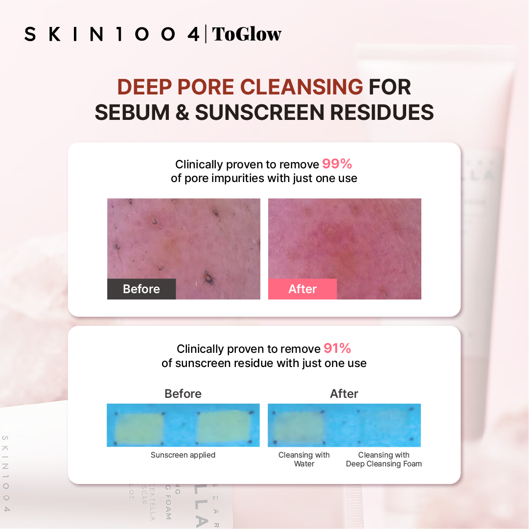 [SKIN1004] Madagascar Centella Poremizing Deep Cleansing Foam 125ml | Pore-Cleansing Foam with Himalayan Pink Salt
