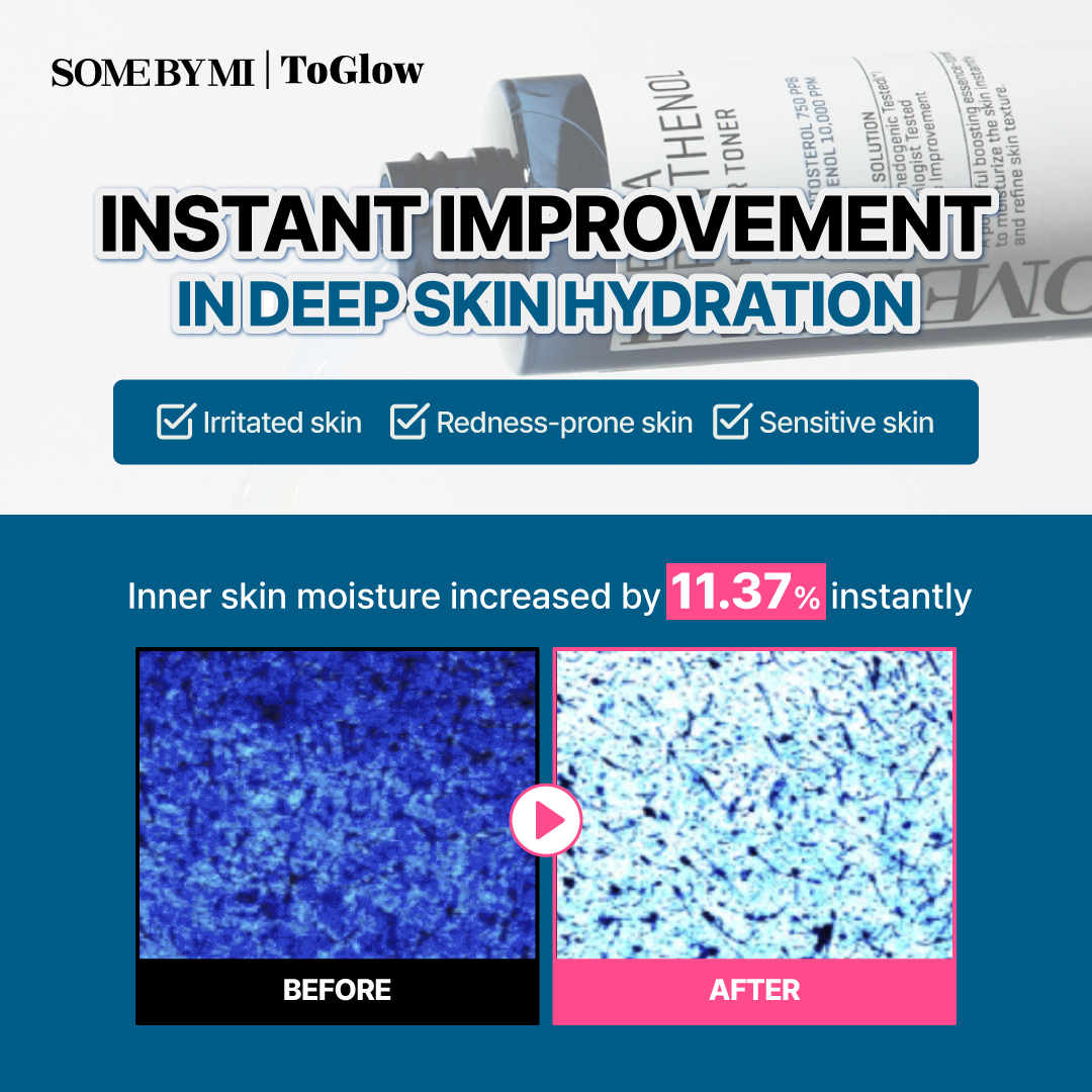 [SOME BY MI] Beta Panthenol Repair Toner 150ml | Repairing Toner for Barrier Strength & Hydration