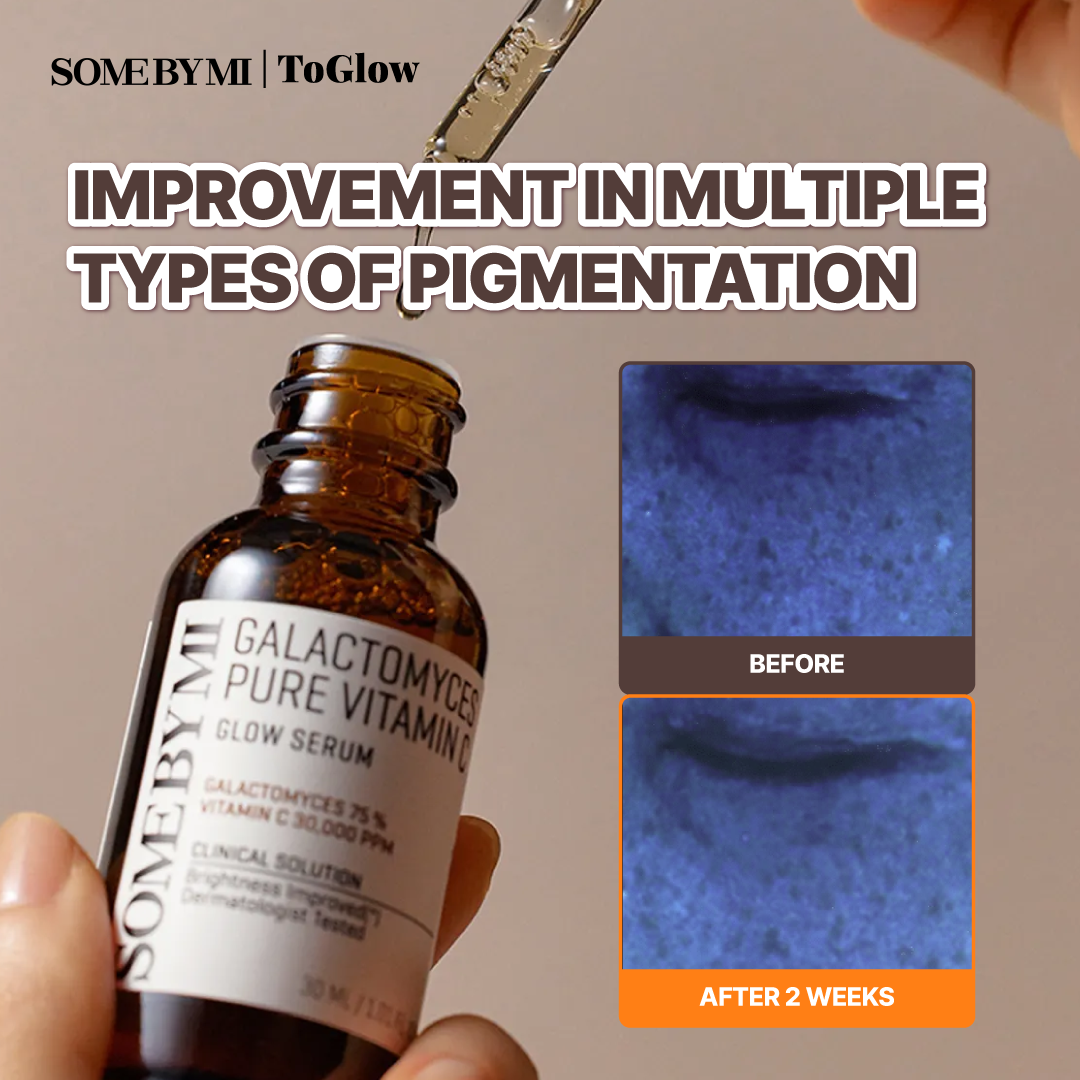 [SOME BY MI] Galactomyces Pure Vitamin C Glow Serum 30ml | Glow Serum for Bright & Youthful Skin