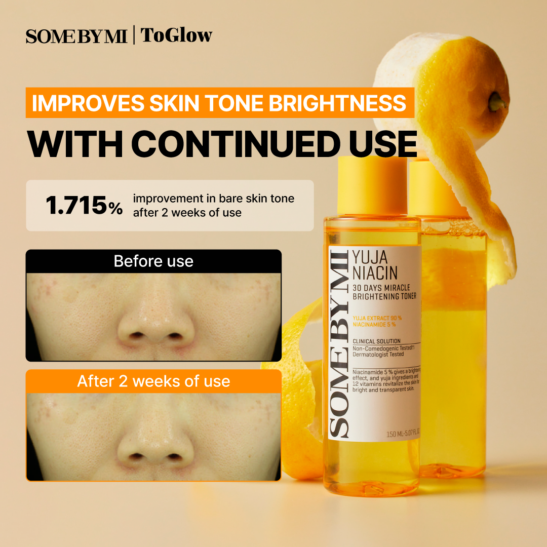 [SOME BY MI] Yuja Niacin 30 Days Miracle Brightening Toner 150ml | Brightening Toner for Radiance & Even Tone