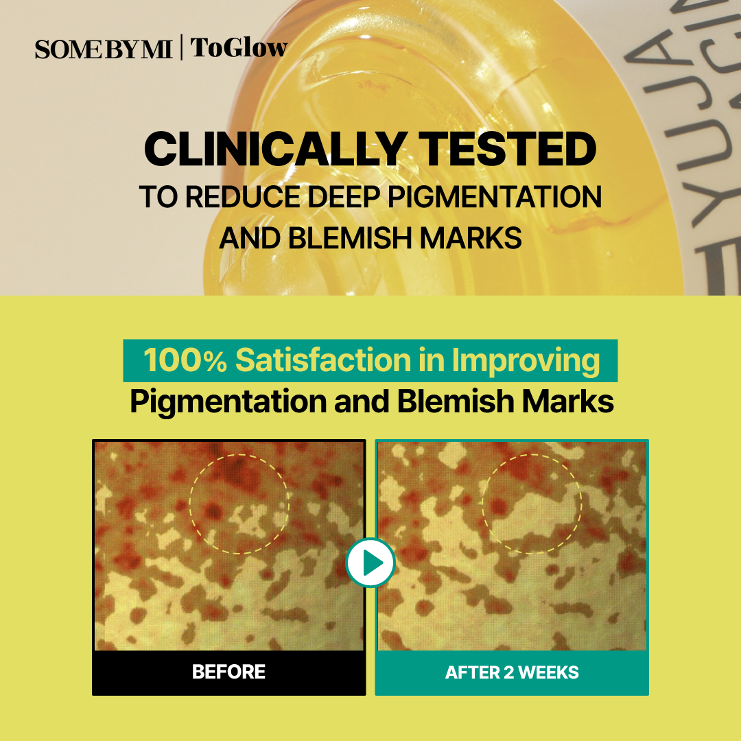 [SOME BY MI] Yuja Niacin Anti-Blemish Serum 50ml | Brightening Serum for Dark Spots & Pigmentation