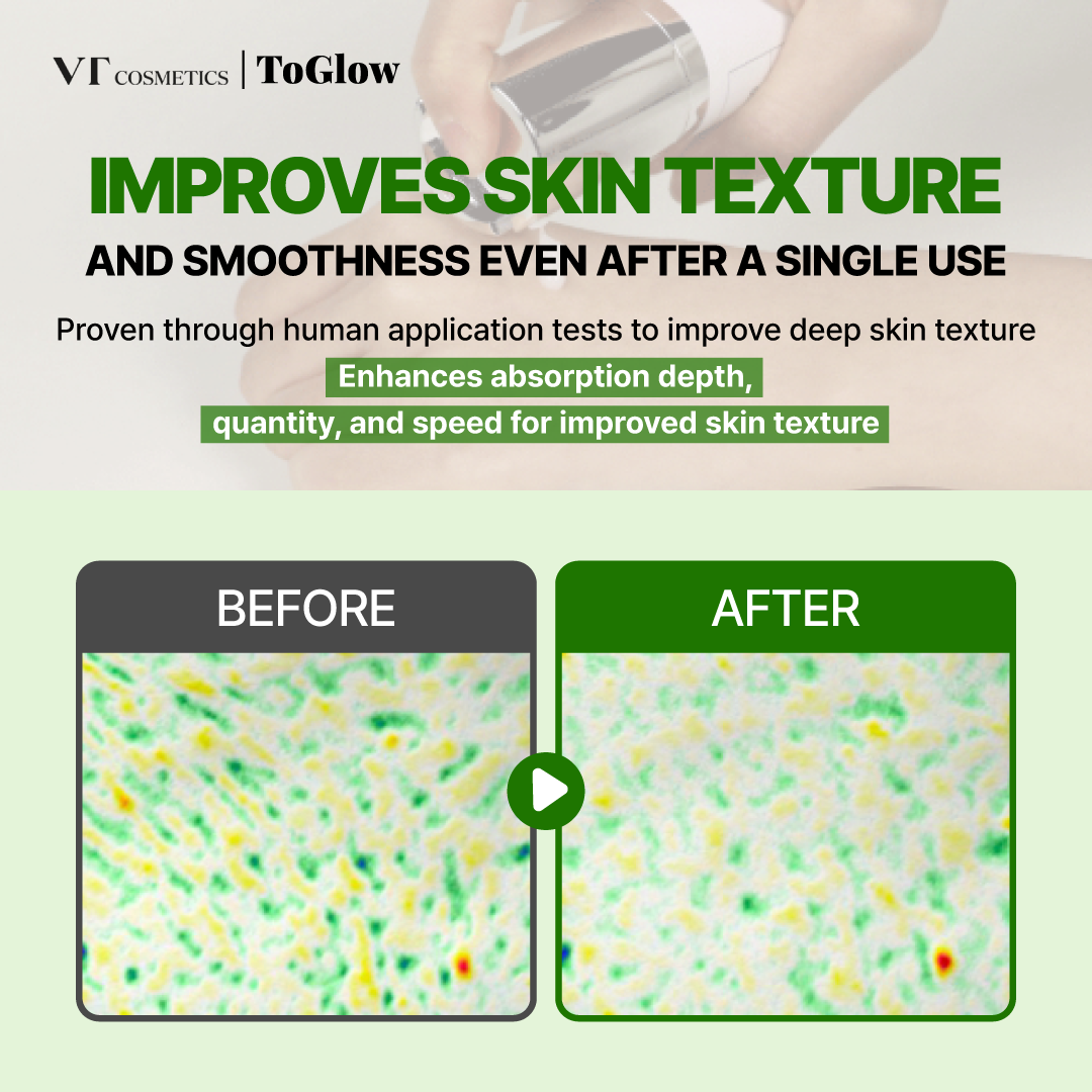 [VT] Reedle Shot 300 50ml | Advanced Booster for Textural Refinement