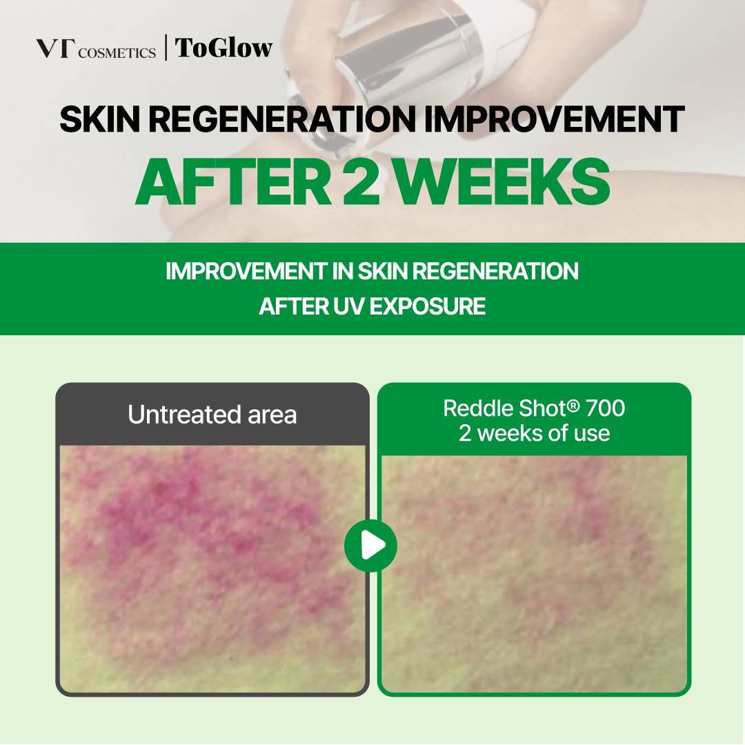 VT Reedle Shot | Daily Booster for Glass Skin & Deep Absorption
